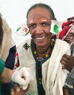 A photo showing one of the patients treated for cataracts by Dr. Ianchulev and the team of doctors taking part in the cataract blindness prevention mission with Himalayan Cataract project and MiniCap Global Alliance, who donated miLOOP devices.