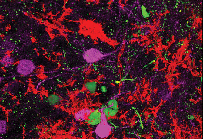 An image showing excitatory neurons of the mouse prefrontal cortex stained by immunohistochemistry for CaMKII (red), phospho-ERK (purple) and GFP (green). Credit: Caroline Menard, PhD, Postdoctoral Fellow, Russo Laboratory