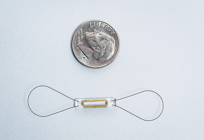 The CardioMEMS™ device is an implanted sensor that checks for increased pressure in the pulmonary artery.